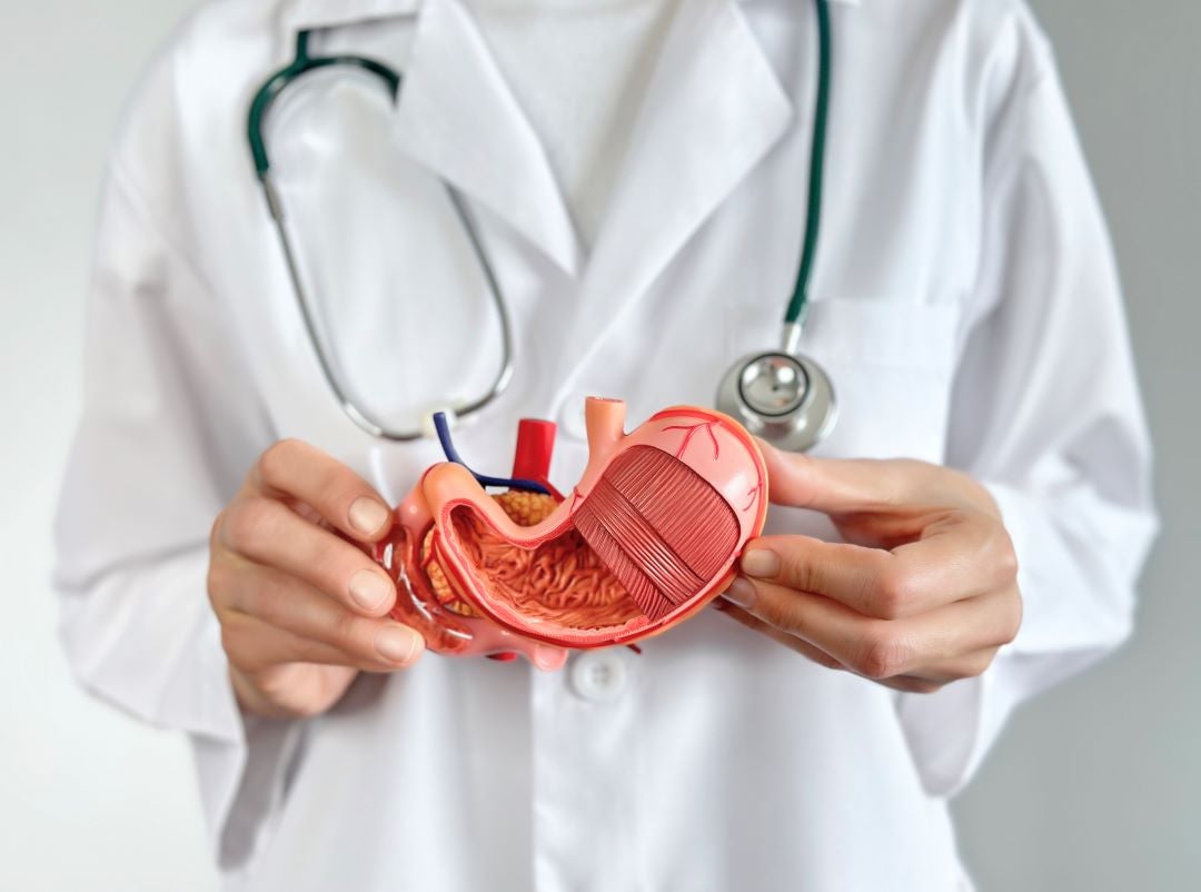 Doctor showing a human stomach model