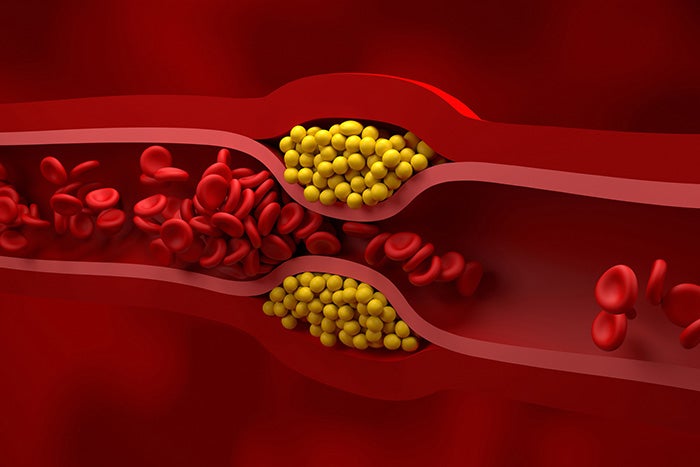 Cholesterol 101: What You Need to Know for a Healthy Heart